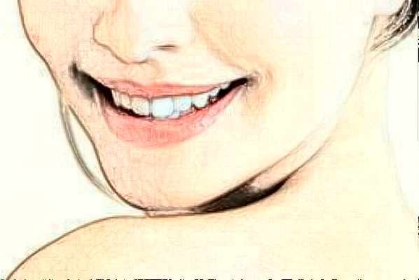 成都圣貝牙科醫(yī)院烤瓷牙好的醫(yī)生推薦_美容日記展示