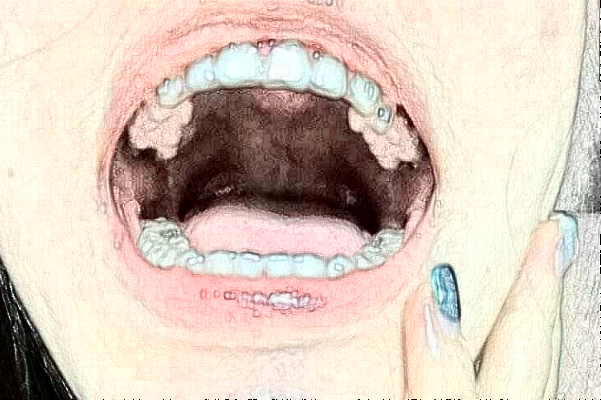河北大學(xué)附屬醫(yī)院牙齒修復(fù)做的好嗎?哪位醫(yī)生做得好