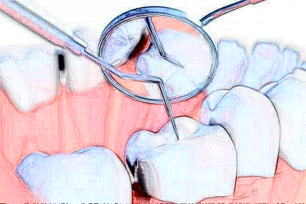 河北大學(xué)附屬醫(yī)院牙齒修復(fù)做的好嗎?哪位醫(yī)生做得好