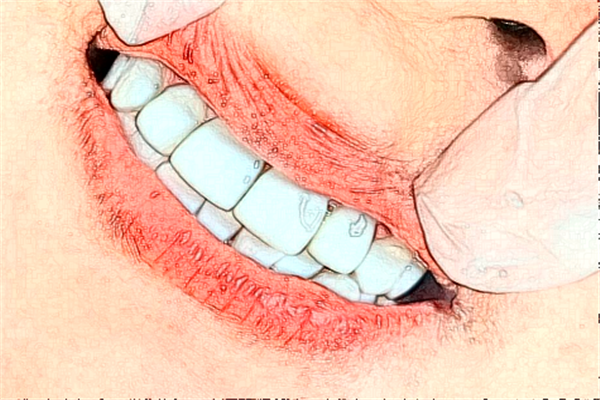 2024貴陽柏德口腔醫(yī)院齙牙矯正怎么樣_體驗日記分享