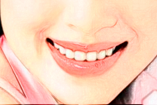 2024河南美奧口腔醫(yī)院矯正牙齒價(jià)格表?矯正牙齒有多疼