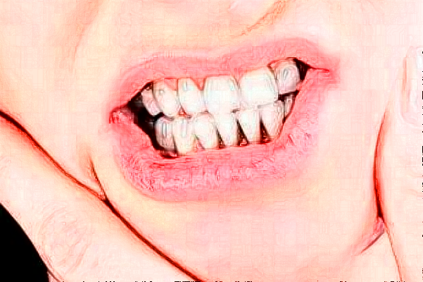 重慶團圓口腔醫(yī)院正畸到底好不好?2024正畸牙齒的費用