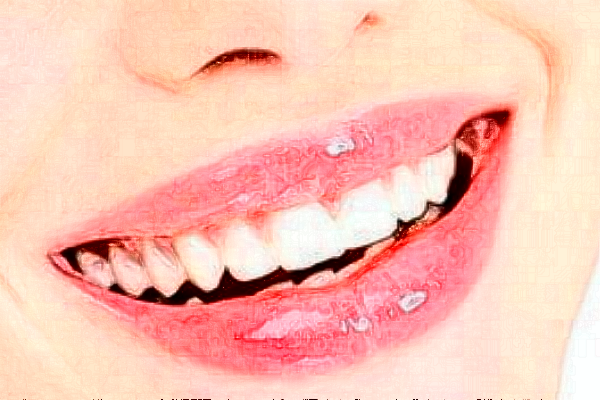 義烏傅氏口腔門診部拔牙痛不痛?拔牙需要多少時間