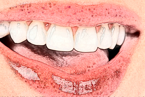 義烏傅氏口腔門(mén)診部矯正牙齒怎么樣?矯正牙齒要多久