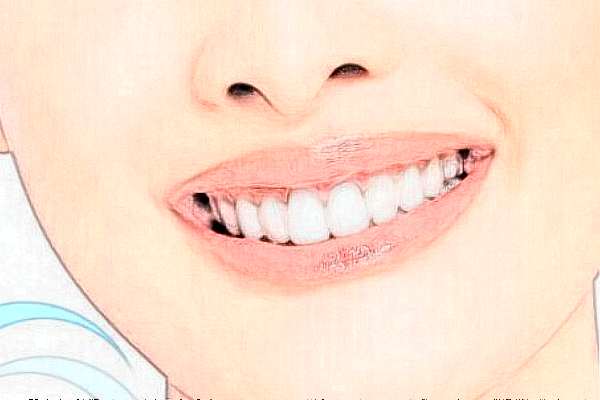 義烏傅氏口腔門(mén)診部矯正牙齒怎么樣?矯正牙齒要多久