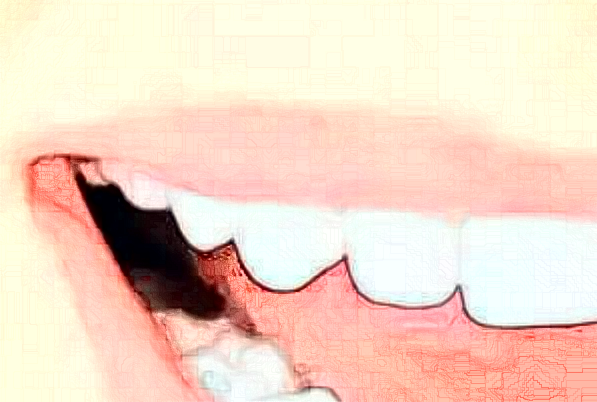 贛州貝殼口腔口腔修復怎么樣，附醫(yī)生信息一覽~