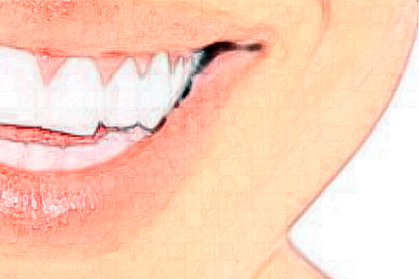 贛州貝殼口腔拔牙怎么樣，附醫(yī)生信息一覽~