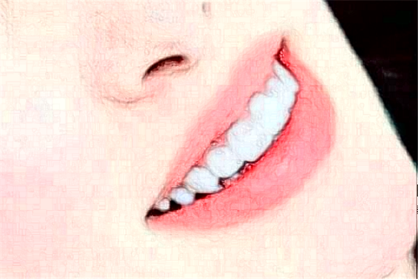 淮安諾貝爾口腔醫(yī)院冷光美白怎么樣?哪個(gè)醫(yī)生好+價(jià)格