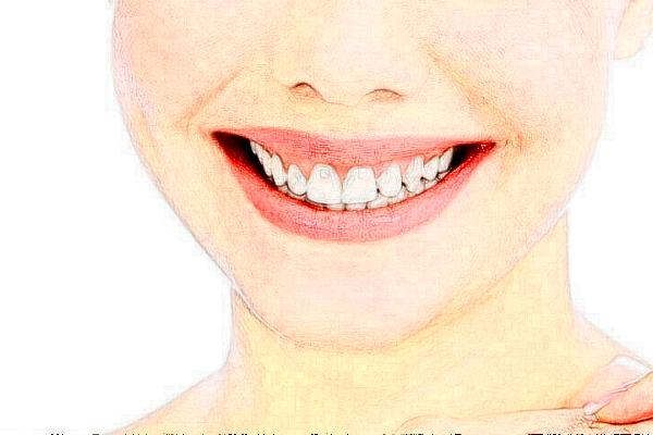 杭州植得口腔門診部正畸怎么樣|價(jià)格|案例