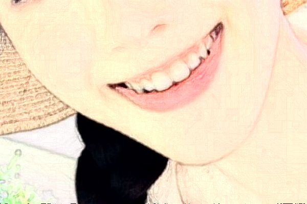 淮安諾貝爾口腔醫(yī)院隱形矯正怎么樣，附醫(yī)生信息一覽~