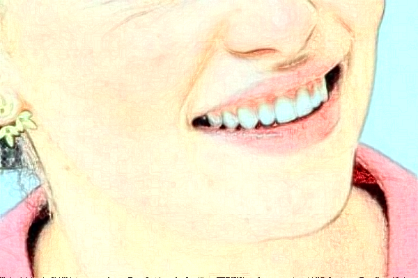 淮安諾貝爾口腔醫(yī)院隱形矯正怎么樣，附醫(yī)生信息一覽~