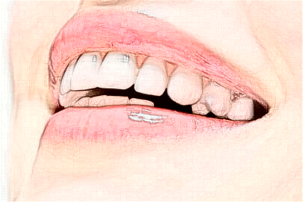 重慶齊美口腔門診部虎牙矯正好么?醫(yī)生推薦+整形案例參考~