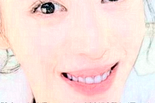 2024太原眾牙口腔醫(yī)院烤瓷牙價(jià)格多少?整形日記全過(guò)程分享