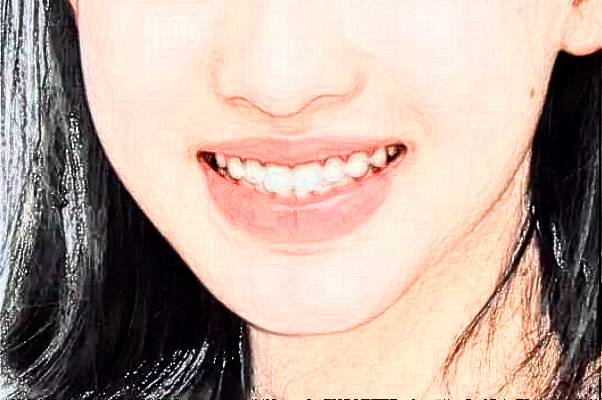 2024義烏傅氏口腔門診部超聲波洗牙價格?超聲波洗牙案例