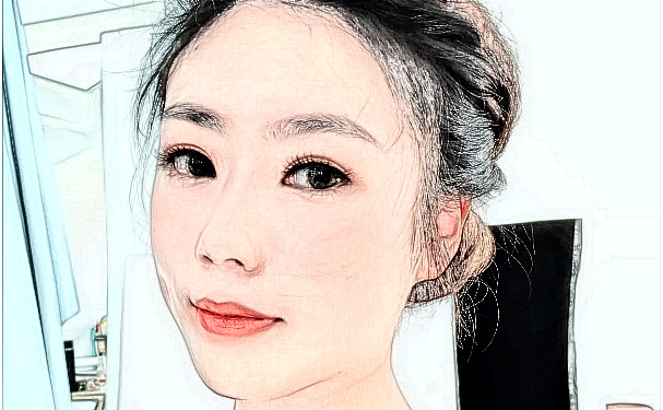 泉州豐澤西華醫(yī)療美容門診部玻尿酸去頸紋技術怎么樣?術后一年野生案例