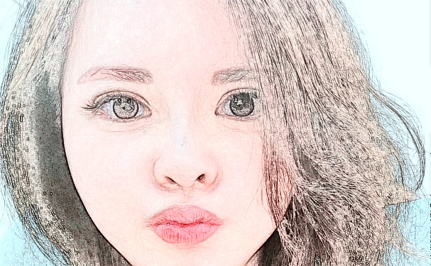 上海瑰麗醫(yī)療美容門診部打玻尿酸術(shù)后三個月求美案例|技術(shù)亮點怎么樣?需要多少錢