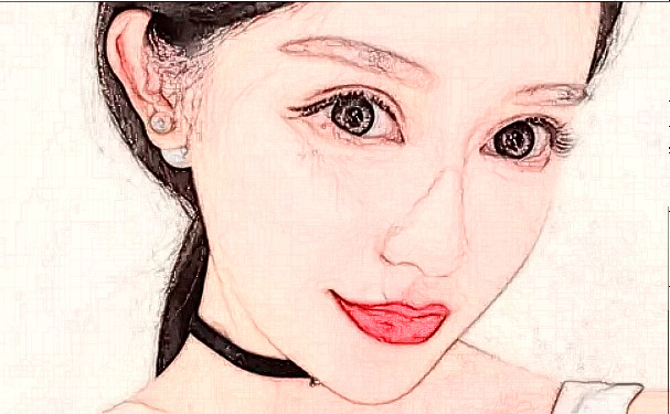 福州鼓樓醫(yī)院玻尿酸填充下巴技術(shù)怎么樣?價(jià)格表?90天案例曝光