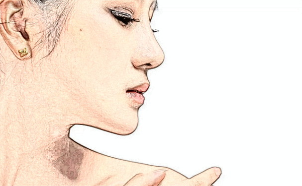 濟南韓氏外科整形醫(yī)院玻尿酸填充技術等級怎么樣?術后案例&價格一覽表