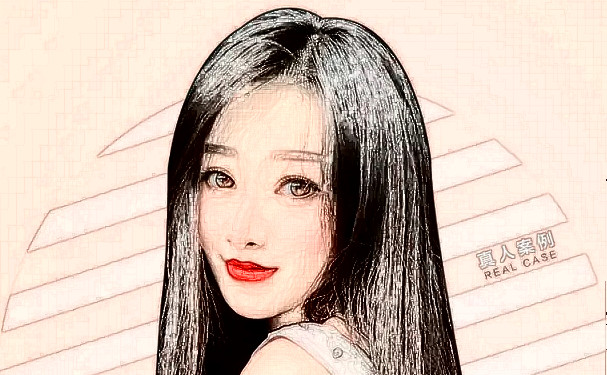 青島市南區(qū)諾美德醫(yī)學(xué)美容門診部打玻尿酸技術(shù)等級怎么樣?野生案例&價目一覽表