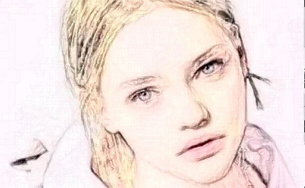 北京藝美碩德醫(yī)療美容診所射頻除皺技術(shù)級(jí)別怎么樣?術(shù)后三個(gè)月案例反饋