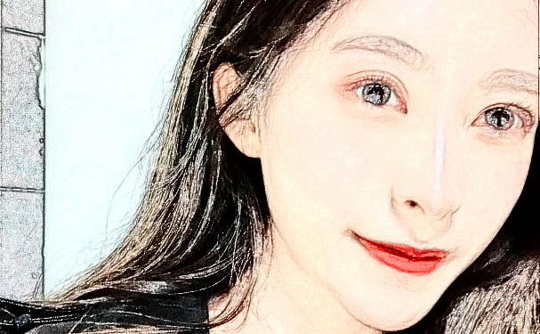 濟(jì)南愛(ài)容整形美容醫(yī)院玻尿酸填充下巴技術(shù)等級(jí)怎么樣?術(shù)后案例&一般多少錢(qián)