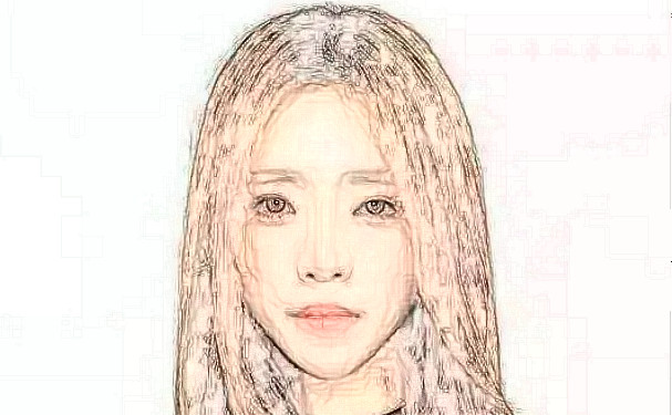 沈陽和平藍天醫(yī)療美容門診部玻尿酸填充全臉費用多少?技術亮點&術后半年求美案例