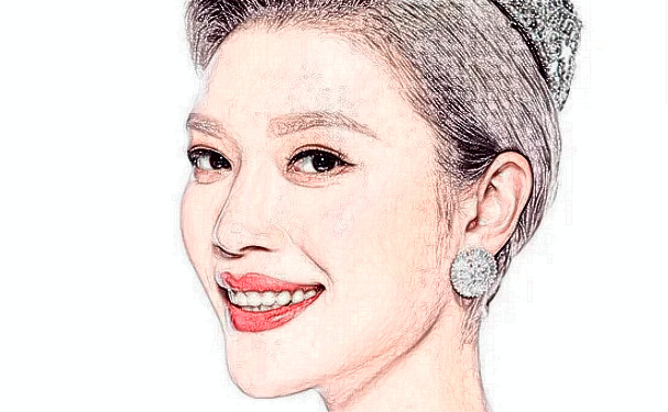 麗水黃君曼整形醫(yī)院去頸紋技術(shù)怎么樣?費(fèi)用查詢?半年親測(cè)案例全解