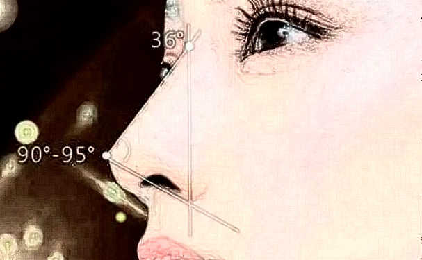 廈門同安新開元醫(yī)院鼻綜合術(shù)后半年案例反饋&技術(shù)怎么樣?