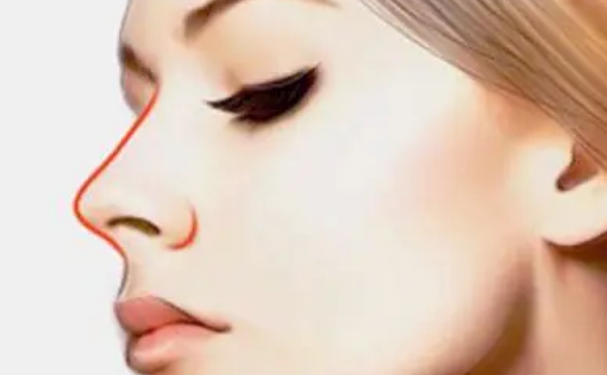 蘭州亞韓整形醫(yī)院整鼻子價(jià)格?技術(shù)亮點(diǎn)&術(shù)后半年案例欣賞