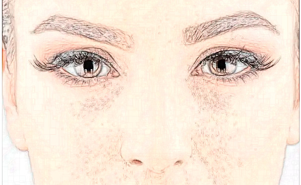 上海薇琳醫(yī)療美容醫(yī)院微創(chuàng)雙眼皮技術(shù)怎么樣?半年案例恢復(fù)過(guò)程|報(bào)價(jià)多少