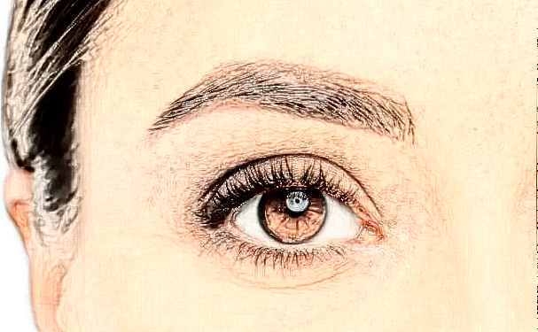 寧波壬美整形醫(yī)院做雙眼皮技術(shù)特點怎么樣?120天經(jīng)典案例