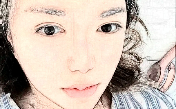 上海萬麗醫(yī)療美容門診部切雙眼皮術(shù)后半年案例揭秘(效果怎么樣?技術(shù)優(yōu)勢(shì))