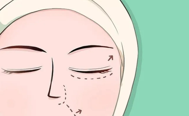 上海萬麗醫(yī)療美容門診部切雙眼皮術(shù)后半年案例揭秘(效果怎么樣?技術(shù)優(yōu)勢(shì))