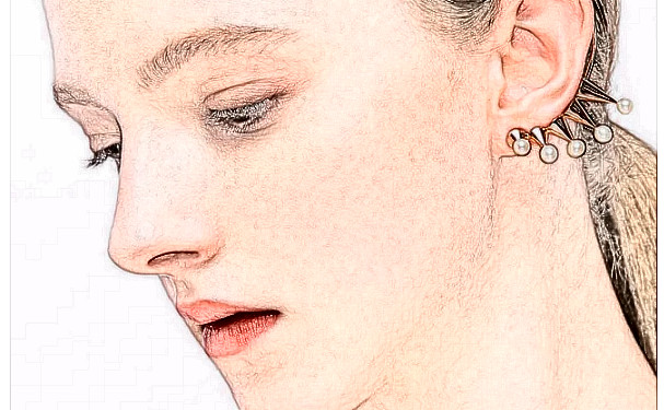 孝感天妃整形扇形雙眼皮技術(shù)怎么樣?費用標準?三個月案例恢復過程