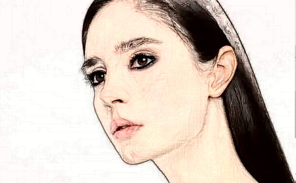 大連市星妍醫(yī)療美容診所新月雙眼皮技術(shù)評(píng)測(cè)怎么樣?術(shù)后半年案例揭秘