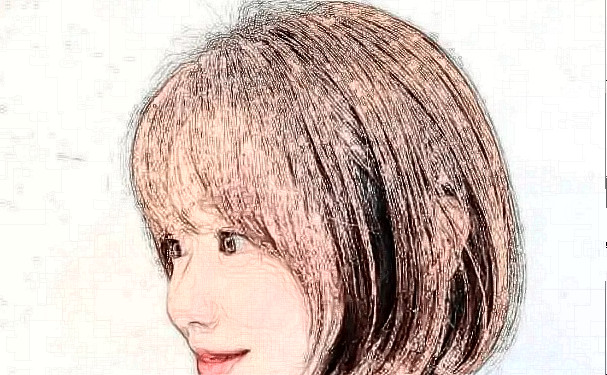 寧波尚麗整形醫(yī)院植發(fā)技術(shù)怎么樣?120天術(shù)后恢復(fù)案例