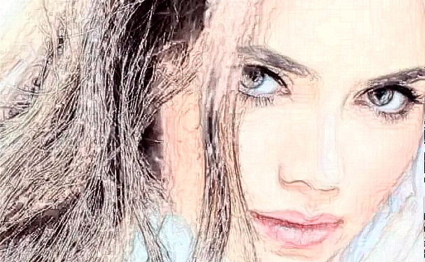 成都武侯艾米麗醫(yī)療美容門診部植發(fā)技術(shù)怎么樣?術(shù)后半年經(jīng)典案例