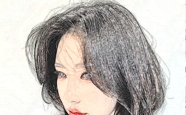 常德愛思特醫(yī)療美容門診部種植頭發(fā)150天術后案例展示&價格?