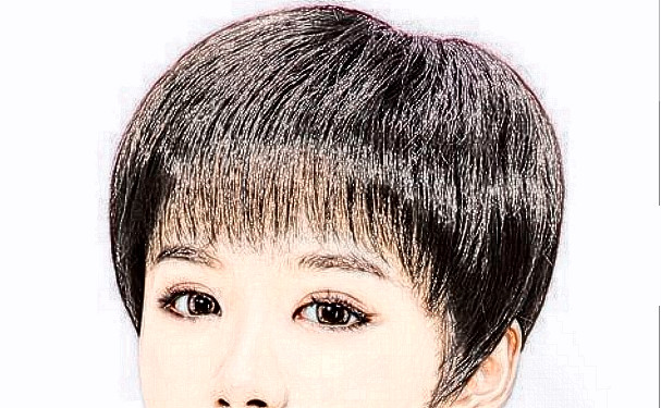 碧蓮盛美學(xué)植發(fā)（寧波分院）植發(fā)120天野生案例|技術(shù)評(píng)價(jià)怎么樣?價(jià)格查詢