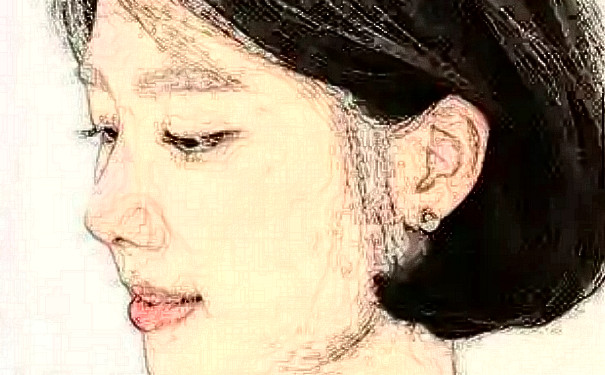 長沙華韓華美醫(yī)療美容醫(yī)院植發(fā)技術怎么樣?報價多少?案例曝光