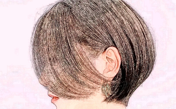 蘭州美月醫(yī)療美容醫(yī)院植發(fā)技術(shù)優(yōu)點(diǎn)怎么樣?案例盤點(diǎn)&一般多少錢