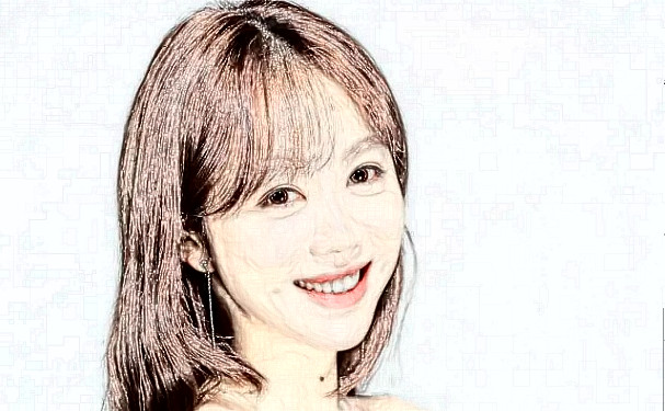 中山愛(ài)思特美容醫(yī)院植發(fā)120天案例點(diǎn)評(píng)(效果怎么樣?技術(shù)優(yōu)點(diǎn))