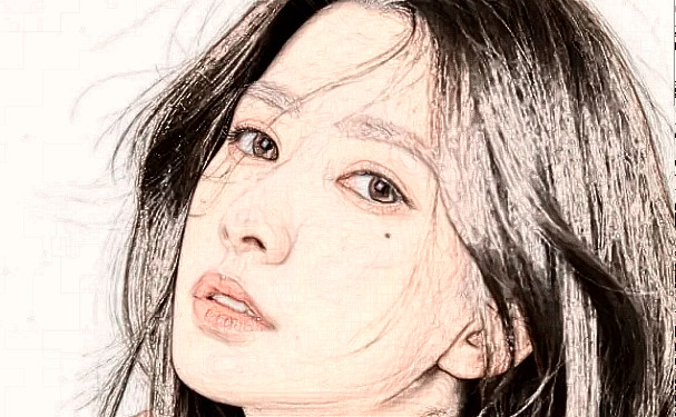 上海陳兵醫(yī)療美容臉部脂肪填充技術(shù)怎么樣?120天親測(cè)案例全解