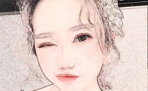 八大處整形醫(yī)院劉立強(qiáng)眼部祛皺求美案例&技術(shù)怎么樣?