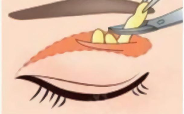 武漢兒童醫(yī)院雙眼皮需要多少錢?求美案例,醫(yī)院簡介