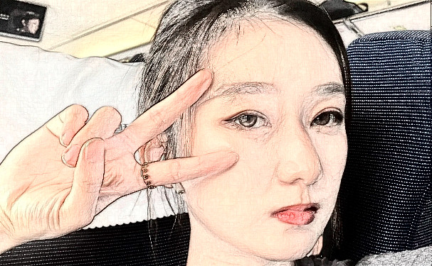 上海長征醫(yī)院李由激光祛斑技術(shù)怎么樣?效果詳情|收費標(biāo)準(zhǔn)