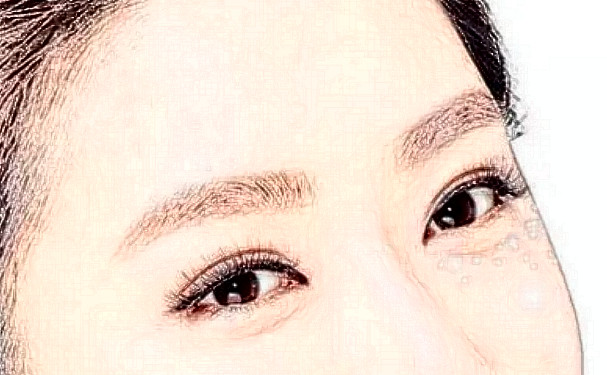 淮安市第一人民醫(yī)院脂肪填充醫(yī)生排名,價格一覽表?術(shù)后案例