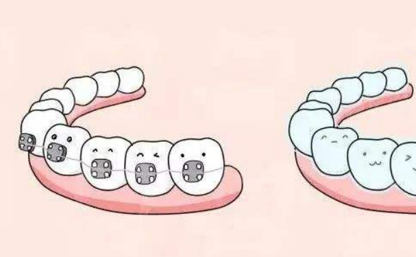 廣元市中心醫(yī)院牙齒歪斜矯正醫(yī)生排名,技術評測&醫(yī)院優(yōu)勢