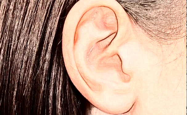 中國(guó)人民解放軍聯(lián)勤保障部隊(duì)第九〇〇醫(yī)院招風(fēng)耳整形技術(shù)怎么樣?醫(yī)院信息