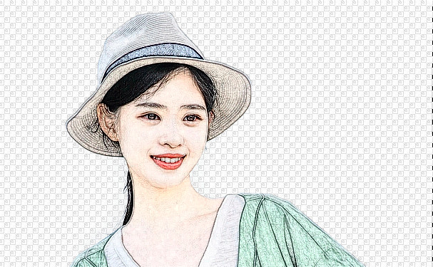 河北醫(yī)科大學(xué)第二醫(yī)院玻尿酸注射淚溝技術(shù)怎么樣?收費標(biāo)準(zhǔn)?野生案例